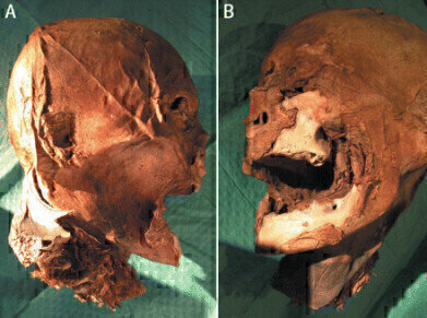 Identification of King Henry IV’s Head