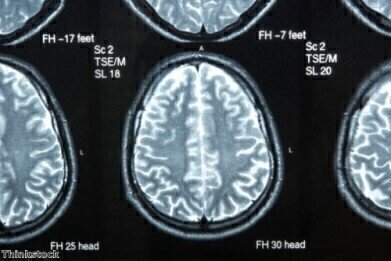 New drug proves effective at brain cancer treatment