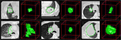 Researchers Use Cost Effective Technology to Unravel Cancer Through Standard Imaging
