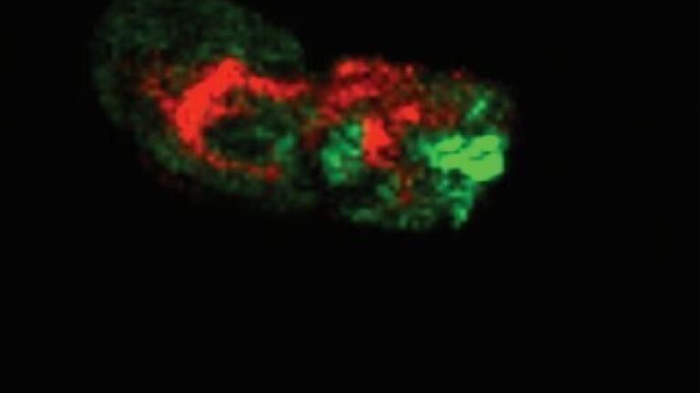 Advances in Multi-mode Mass Spectrometry for Tissue Imaging Studies