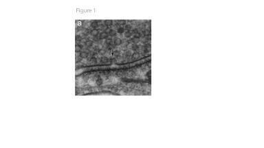 Flash-and-freeze Electron Microscopy – Adding Motion to Electron Micrographs