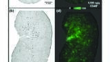 Boosting Discovery and Early Development of Drug Candidates with New MALDI Technology