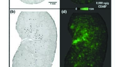 Boosting Discovery and Early Development of Drug Candidates with New MALDI Technology