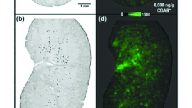 Boosting Discovery and Early Development of Drug Candidates with New MALDI Technology