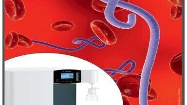 Conducting Research on Highly Pathogenic Viruses Using Virus Pseudotypes - The Influence of Ultrapure Water on Data Quality
