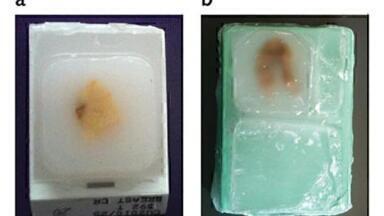 Unlocking the archive - Chromatrap® ChIP from Formula Fixed Paraffin Embedded (FFPE) Tissue