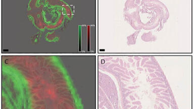 Translating Proteomic MALDi Tissue Typing in Clinical Research Pathology