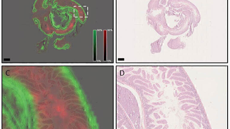 Translating Proteomic MALDi Tissue Typing in Clinical Research Pathology