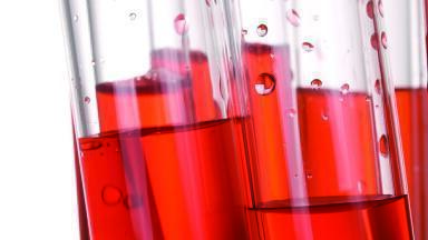 Spectrophotometry: How to ensure essential measurements can be made precisely and accurately