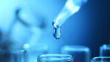 Towards smart water analysis - The road to predictive preventative maintenance in online TOC monitoring