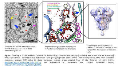 Understanding the inner universe with Cryo-Electron Tomography