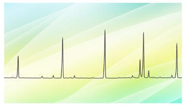 Determination of the instrument detection limit of the ISQ 7610 single quadrupole GC-MS with the ExtractaBrite electron ionisation source