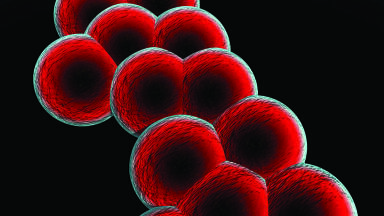 A Novel Biomarker-Based Prostate Screening Method to Reduce Unnecessary Biopsies