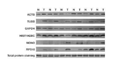 Data Normalisation - An analytical approach for reliable western blot analysis