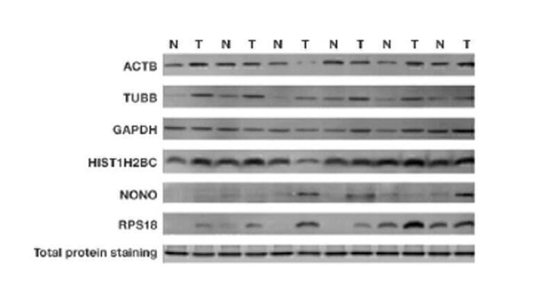 Data Normalisation - An analytical approach for reliable western blot analysis
