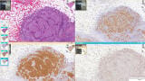 Digital pathology promises to end the constraints of geography and diagnosis
