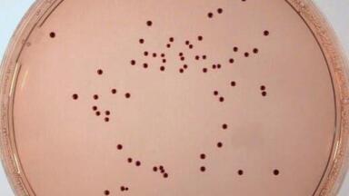 Enterococci Media Now Cover Wide Range of Applications