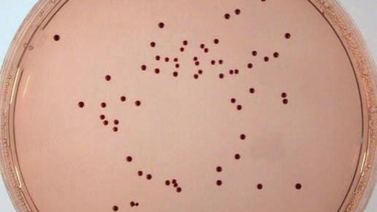 Enterococci Media Now Cover Wide Range of Applications