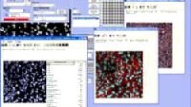 Major Hardware and Software Upgrades Increase Assay Flexibility, Improve Image Capture, Visualization and Analysis