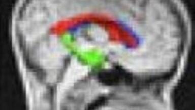 Lab product news from York 'could revolutionise MRI'