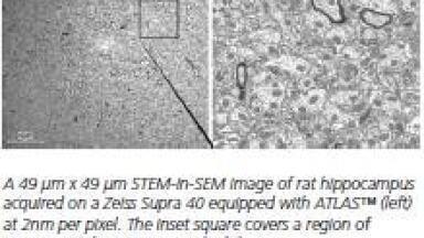 Nanoscopic Analysis of Large-area Samples