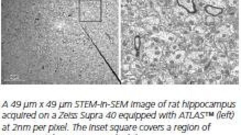 Nanoscopic Analysis of Large-area Samples
