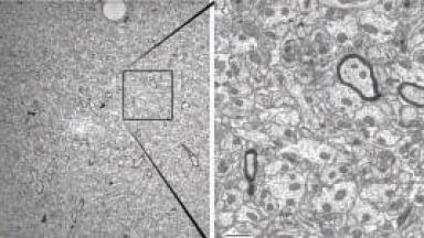 New Opportunities in the Nanoscopic Analysis of Large-area Samples