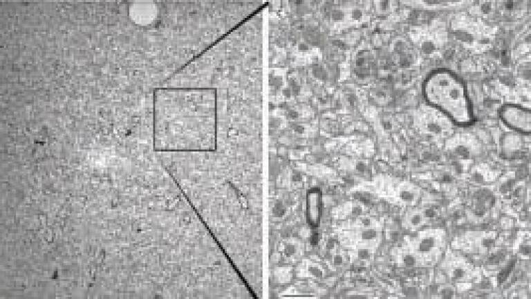 New Opportunities in the Nanoscopic Analysis of Large-area Samples