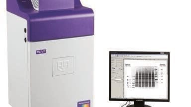 Digital Chemiluminescent Imaging of Protein Blots