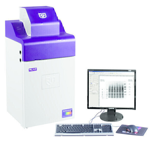 Digital Chemiluminescent Imaging of Protein Blots Labmate Online