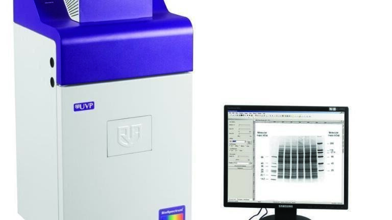 Digital Chemiluminescent Imaging of Protein Blots