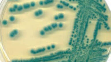 Improved Detection of Micro-organisms in Food