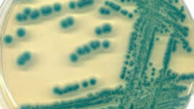 Improved Detection of Micro-organisms in Food