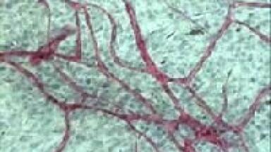 Announcing the Launch of Angiokit® 96 for High Throughput Angiogenesis Assays