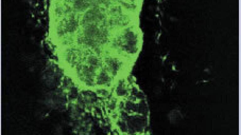 New light on the way organs migrate