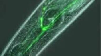 Brighter Fluorescence and TIRF Imaging; Lost Light Recaptured