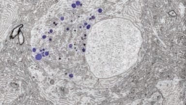 Correlative Light and Electron Microscopy Solution for Life Sciences