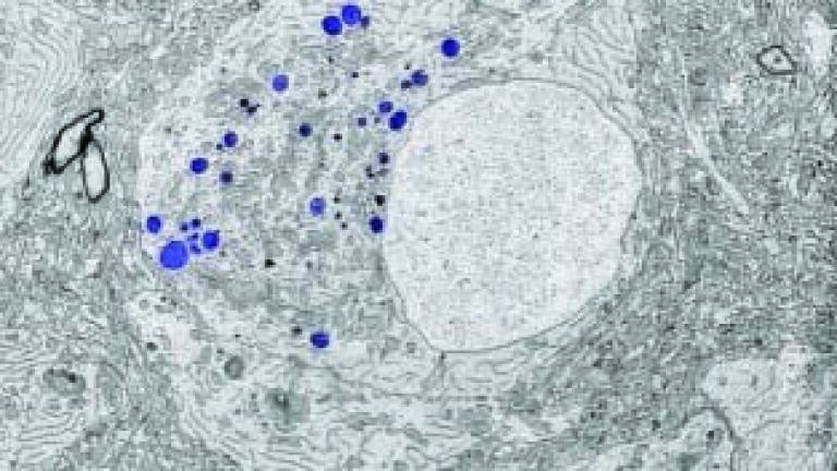 Correlative Light and Electron Microscopy Solution for Life Sciences