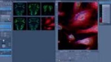 Practical Experimental Intelligence for Laser Scanning Microscopy