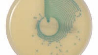 New MRSA Chromogenic Medium