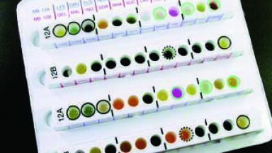 Biochemical Identification Systems Allow Rapid Identification of Clinically Significant Micro-organisms