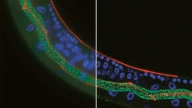 Obtaining Sharper Clearer Images