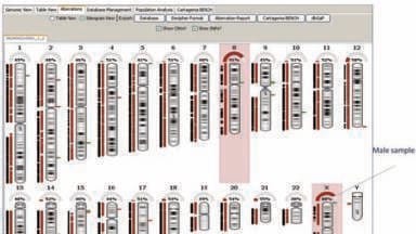 Unique CNV Array with Whole Chromosome Uniparental Disomy Detection