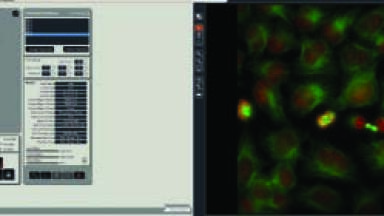 High-Content Screening Automation for Confocal and Widefield Microscopy