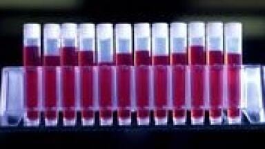 Take Tube Volume Detection to the Next Level