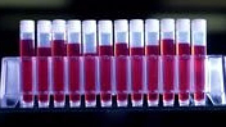 Take Tube Volume Detection to the Next Level