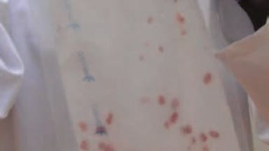 Taking the Strain out of Pipetting