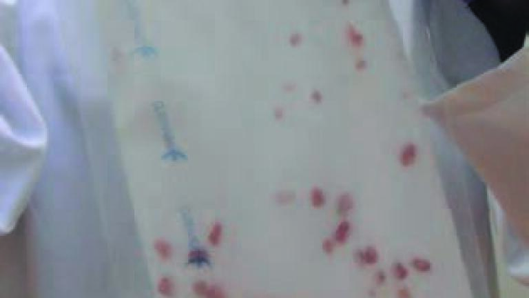 Taking the Strain out of Pipetting