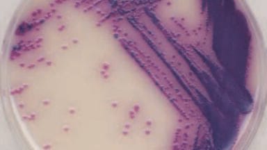 Identifying Salmonella Species in Duck Eggs in Two Days