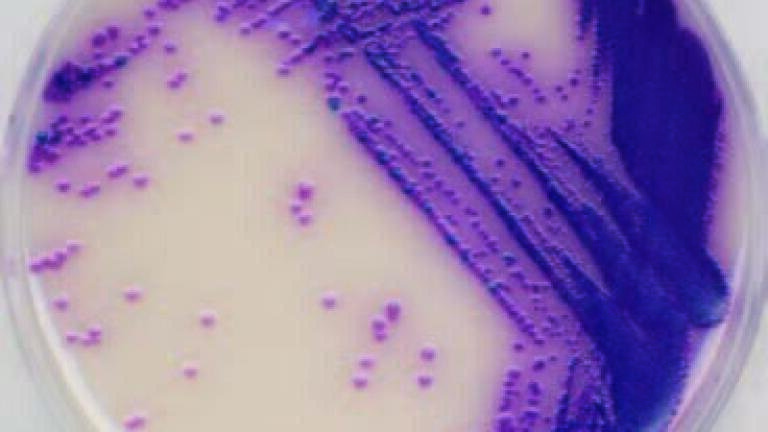 Identifying Salmonella Species in Duck Eggs in Two Days